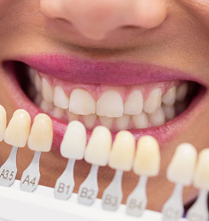 davaridental.gr